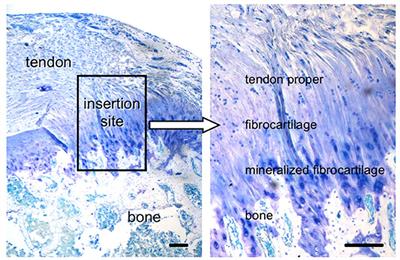 Engineering Musculoskeletal Tissue Interfaces